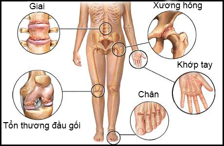 Calcium và phòng chống loãng xương ở mọi lứa tuổi