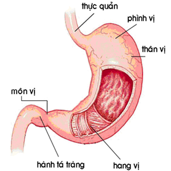 Triệu trứng viêm dạ dày là gì? 